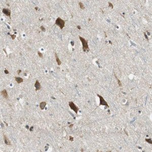 Anti-CNOT3 antibody produced in rabbit HPA006408-100UL