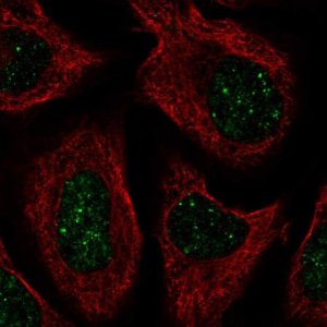 Anti-CNOT7 antibody produced in rabbit 
