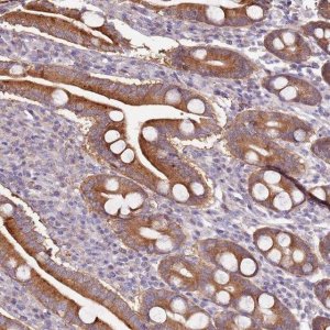 Anti-CNOT9 antibody produced in rabbit 