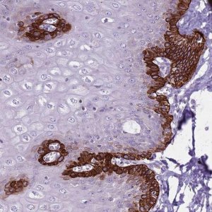 Anti-CNPPD1 antibody produced in rabbit 