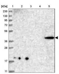 Anti-CNTLN antibody produced in rabbit HPA036728-100UL