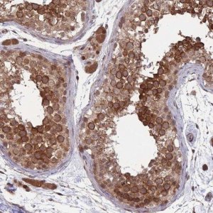 Anti-CNTRL antibody produced in rabbit 
