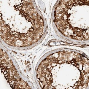 Anti-CNTROB antibody produced in rabbit 