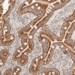 Anti-COA6 antibody produced in rabbit HPA028588-100UL