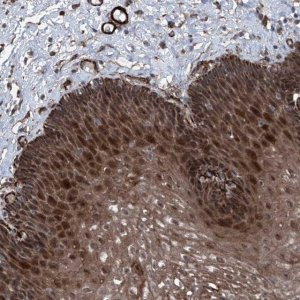 Anti-COA7 antibody produced in rabbit HPA028154-100UL