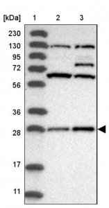 Anti-COA7 antibody produced in rabbit HPA028154-100UL
