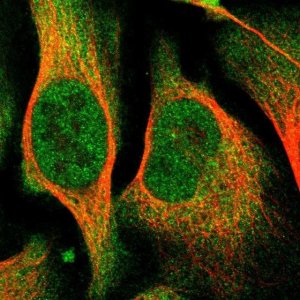 Anti-COASY antibody produced in rabbit 