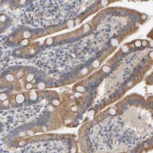 Anti-COASY antibody produced in rabbit HPA022912-100UL