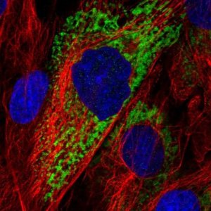 Anti-COL11A1 antibody produced in rabbit 