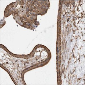 Anti-COL16A1 antibody produced in rabbit HPA027237-100UL