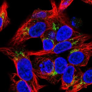 Anti-COL18A1 antibody produced in rabbit 