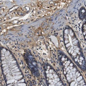 Anti-COL1A1 antibody produced in rabbit 