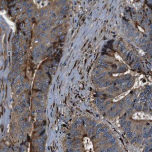 Anti-COL1A1 antibody produced in rabbit 