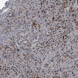 Anti-COL20A1 antibody produced in rabbit 