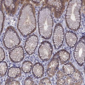 Anti-COL22A1 antibody produced in rabbit 