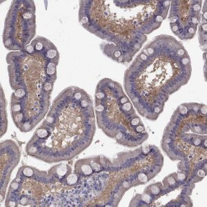 Anti-COL22A1 antibody produced in rabbit 