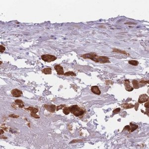 Anti-COL27A1 antibody produced in rabbit 