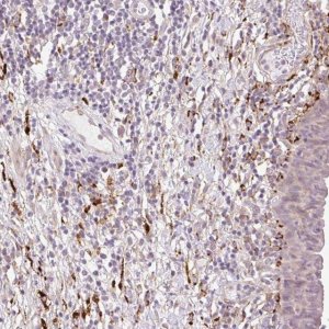 Anti-COL5A1 antibody produced in rabbit 