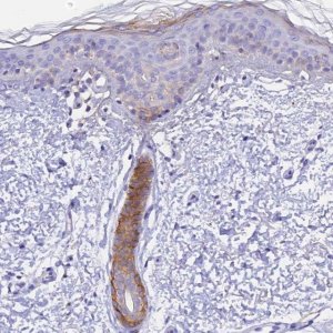 Anti-COL6A5 antibody produced in rabbit 
