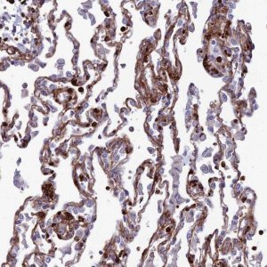Anti-COL6A6 antibody produced in rabbit 