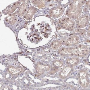 Anti-COL8A2 antibody produced in rabbit 