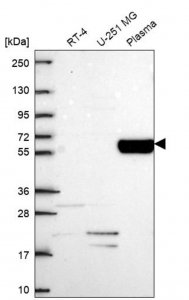 Anti-COL9A2 antibody produced in rabbit HPA075286-100UL