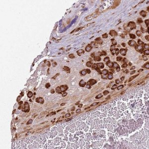 Anti-COLGALT1 antibody produced in rabbit 