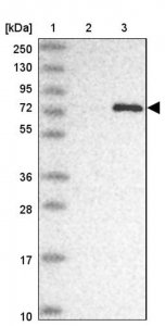 Anti-COLGALT1 antibody produced in rabbit 