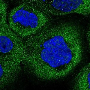 Anti-COLQ antibody produced in rabbit 