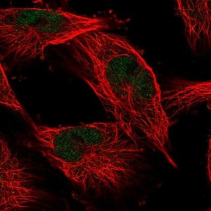 Anti-COMMD1 antibody produced in rabbit 