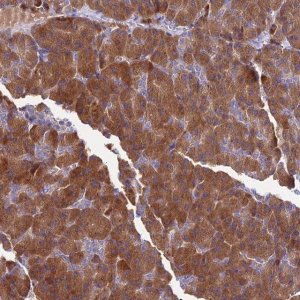 Anti-COMMD10 antibody produced in rabbit 