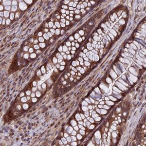 Anti-COMMD2 antibody produced in rabbit 