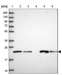 Anti-COMMD2 antibody produced in rabbit 
