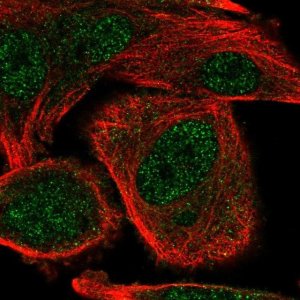 Anti-COMMD5 antibody produced in rabbit 