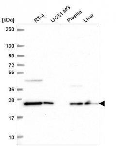Anti-COMMD7 antibody produced in rabbit 