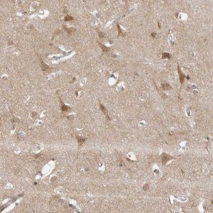 Anti-COPA antibody produced in rabbit 