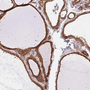 Anti-COPB1 antibody produced in rabbit 