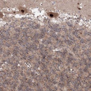 Anti-COPS4 antibody produced in rabbit HPA036894-100UL
