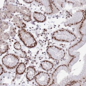 Anti-COPS6 antibody produced in rabbit 