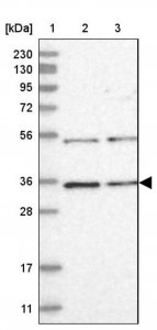 Anti-COPS7B antibody produced in rabbit HPA034675-100UL