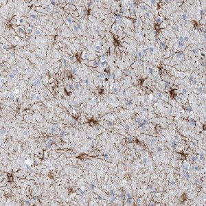 Anti-COPS8 antibody produced in rabbit 