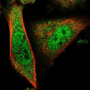 Anti-COPS9 antibody produced in rabbit 