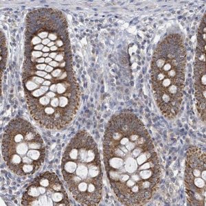 Anti-COQ10B antibody produced in rabbit 
