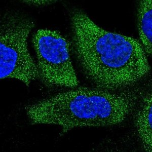 Anti-COQ10B antibody produced in rabbit 