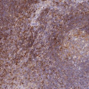 Anti-CORO7 antibody produced in rabbit 