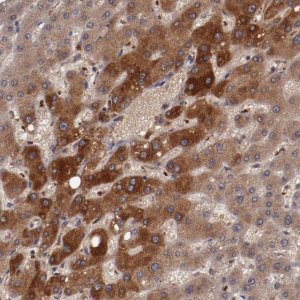 Anti-CP antibody produced in rabbit 