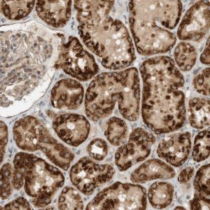 Anti-CPAMD8 antibody produced in rabbit 