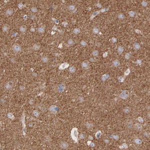 Anti-CPE antibody produced in rabbit 