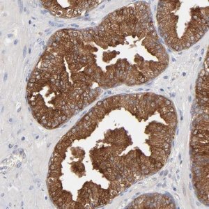 Anti-CPE antibody produced in rabbit 
