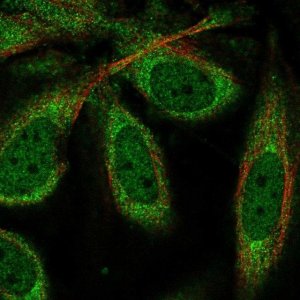 Anti-CPEB1 antibody produced in rabbit 
